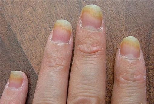 fingernails.jpg